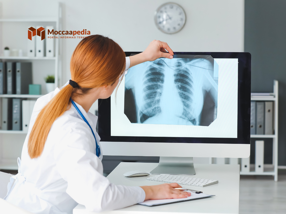 Makanan untuk Penderita Kanker Paru Paru