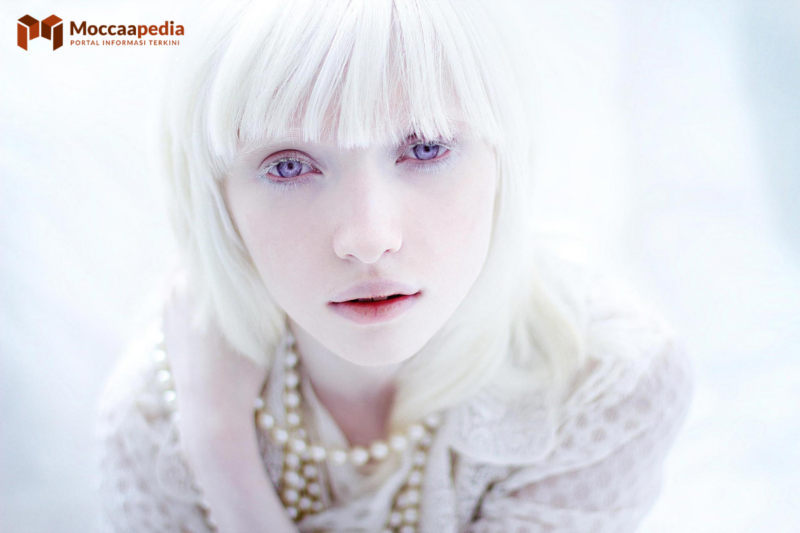 Albino Tercantik di Dunia yang Berprofesi Public Figure
