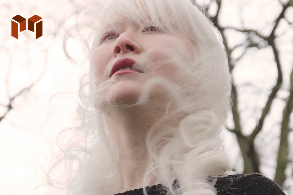Albino Tercantik di Dunia yang Berprofesi Public Figure